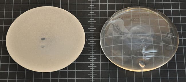 are breast implants associated with cancer 5f7c41ac852d2