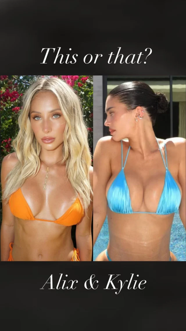There are many variables in breast augmentation: implant volume, shape, manufacturer, and filler substance; incision location; over or under the muscle; patient specific anatomy; and both the surgeon’s and patient’s aesthetic sense. Achieving the best result takes all of these factors into account and, as shown here, there is often more than one way to do it.  Remember, it’s not one and done.  Implants require periodic replacement life long. Fat grafts, as an alternative, do not work. 
#implant #anatomy #muscle